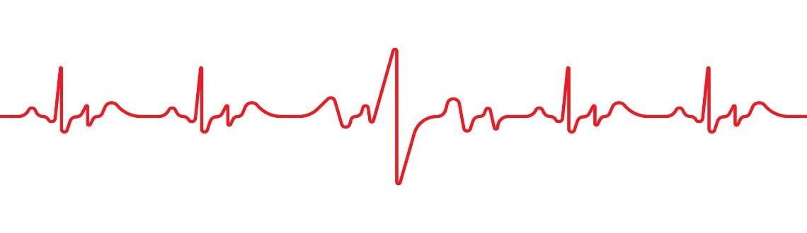 Heartbeat