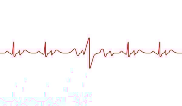 Evaluating and Improving Your Organizational Health